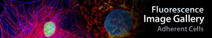 Embryonic Rat Thoracic Aorta Medial Layer Myoblast Cells