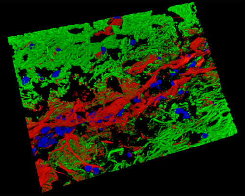 Mouse Brain Tissue