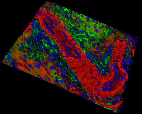 Mouse Ovary Tissue