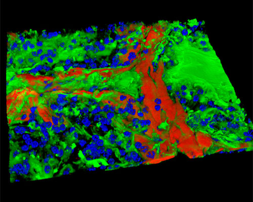 Mouse Prostate Tissue