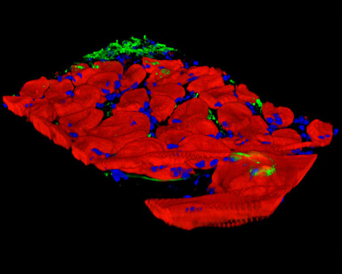 Mouse Prostate Tissue